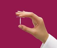 aquidauana-realiza-atendimento-para-colocacao-de-diu-nos-dias-24-e-25-de-fevereiro