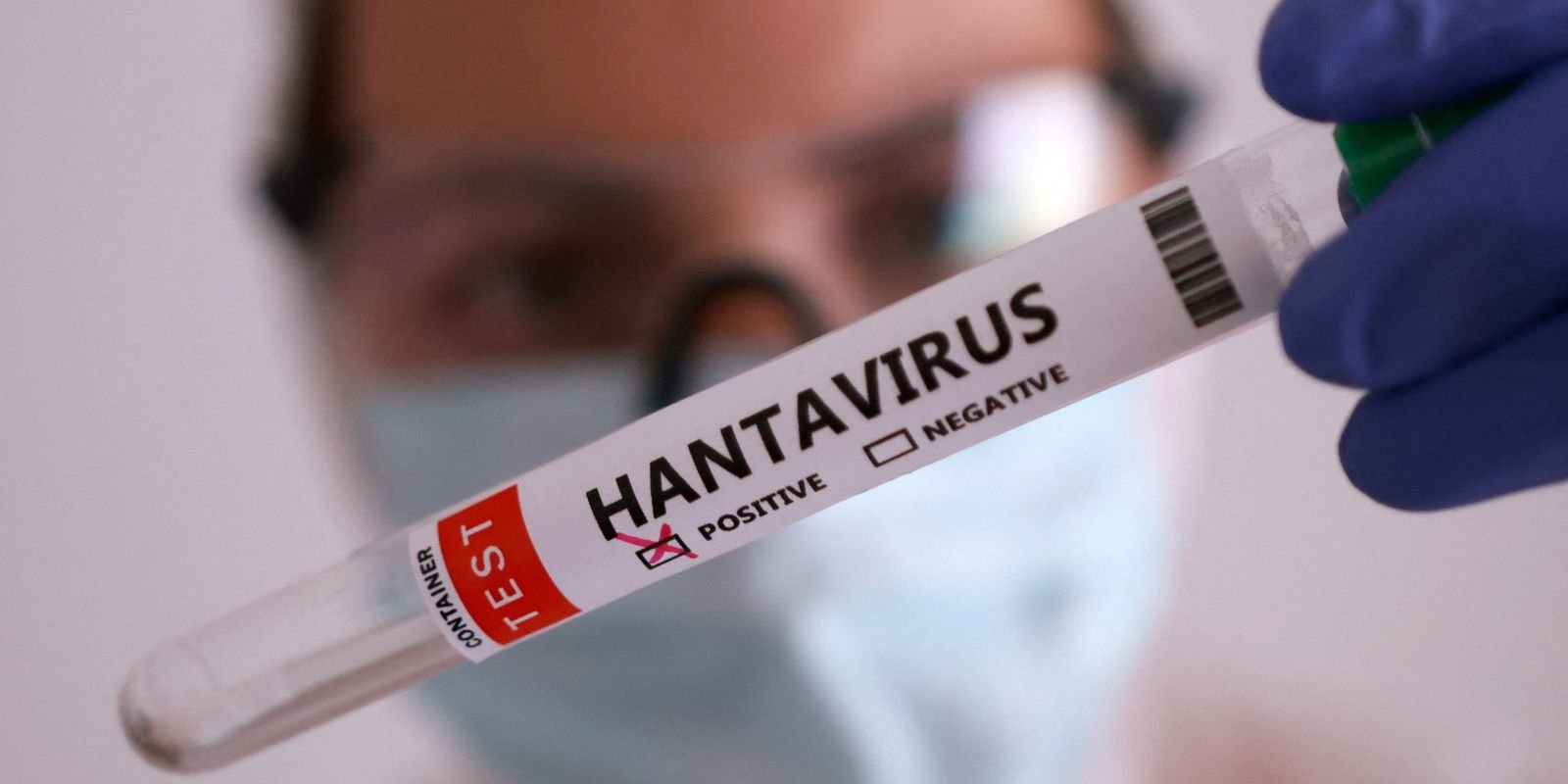 duas-pessoas-retiradas-de-navio-testam-positivo-para-o-hantavirus
