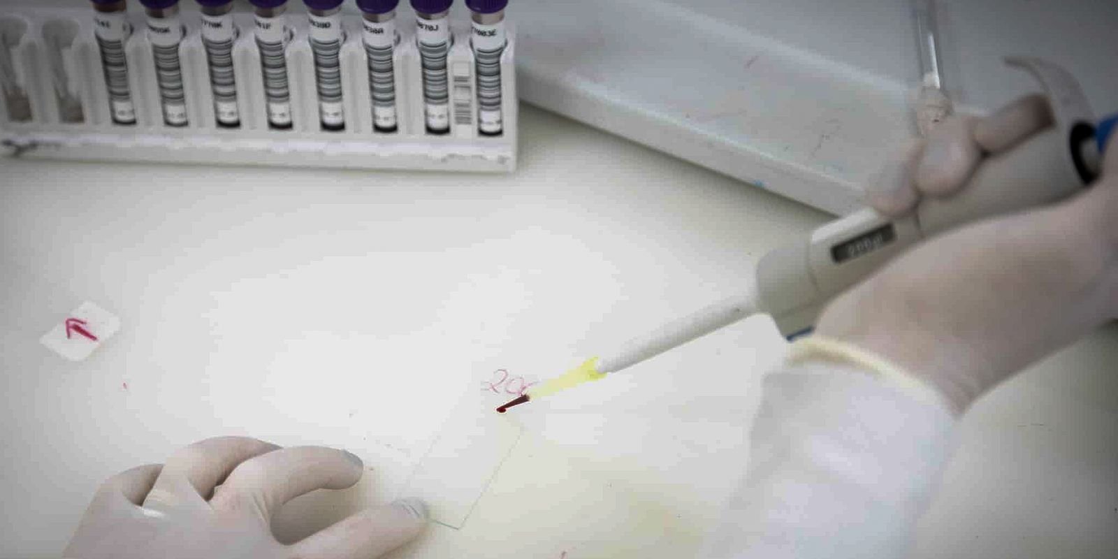 exames-descartam-ebola-em-imigrante-da-republica-democratica-do-congo