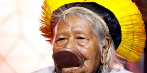 raoni-esta-consciente,-mas-apresenta-leve-piora-no-quadro-renal